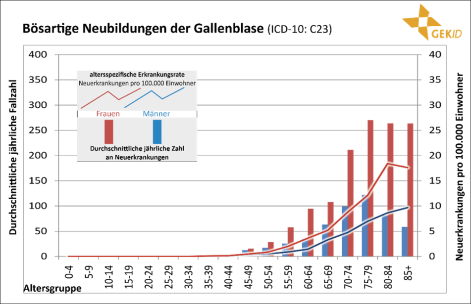 Altersverteilung der Inzidenz maligner biliärer Tumoren in Deutschland (Diagnosejahre 2012-2014) 6 - extrahepatische Cholangiokarzinome