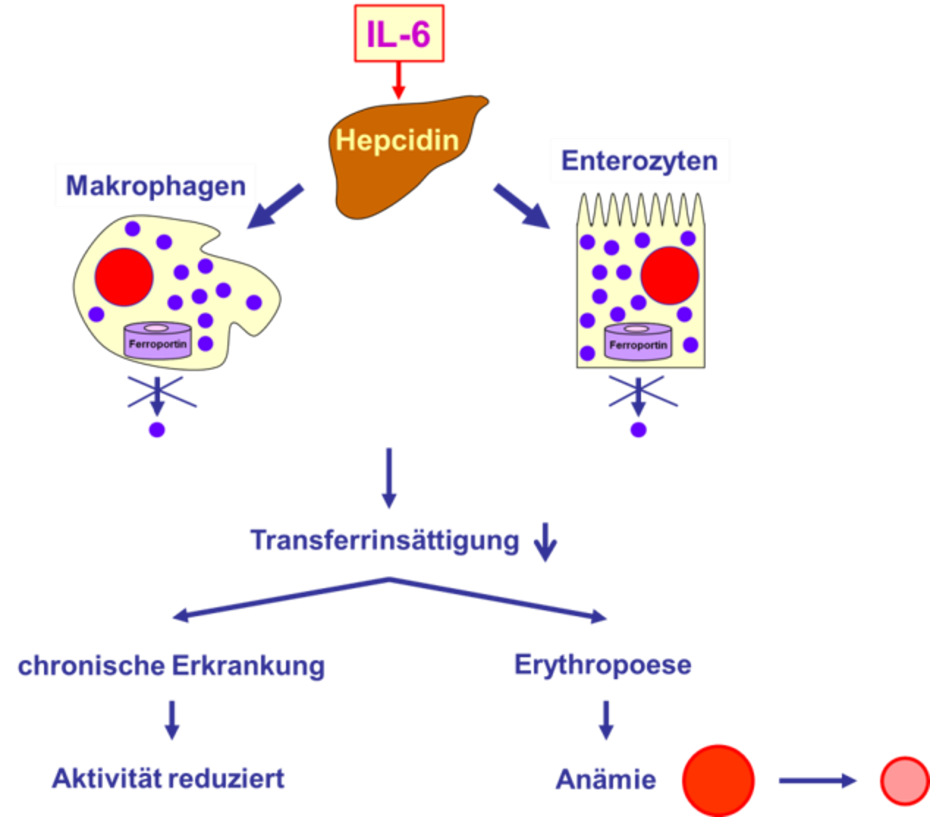 Funktioneller Eisenmangel bei chronischen Erkrankungen