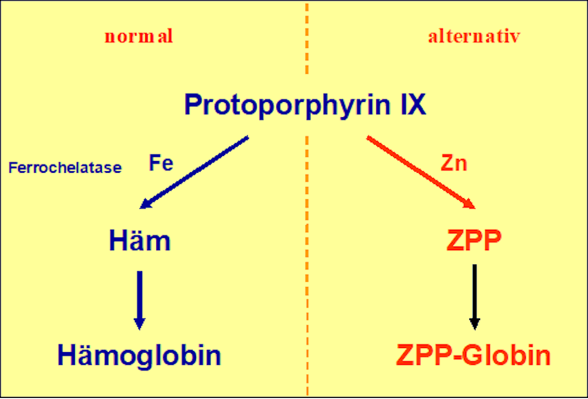 Entstehung von ZPP bei eisendefizitärer Erythropoese