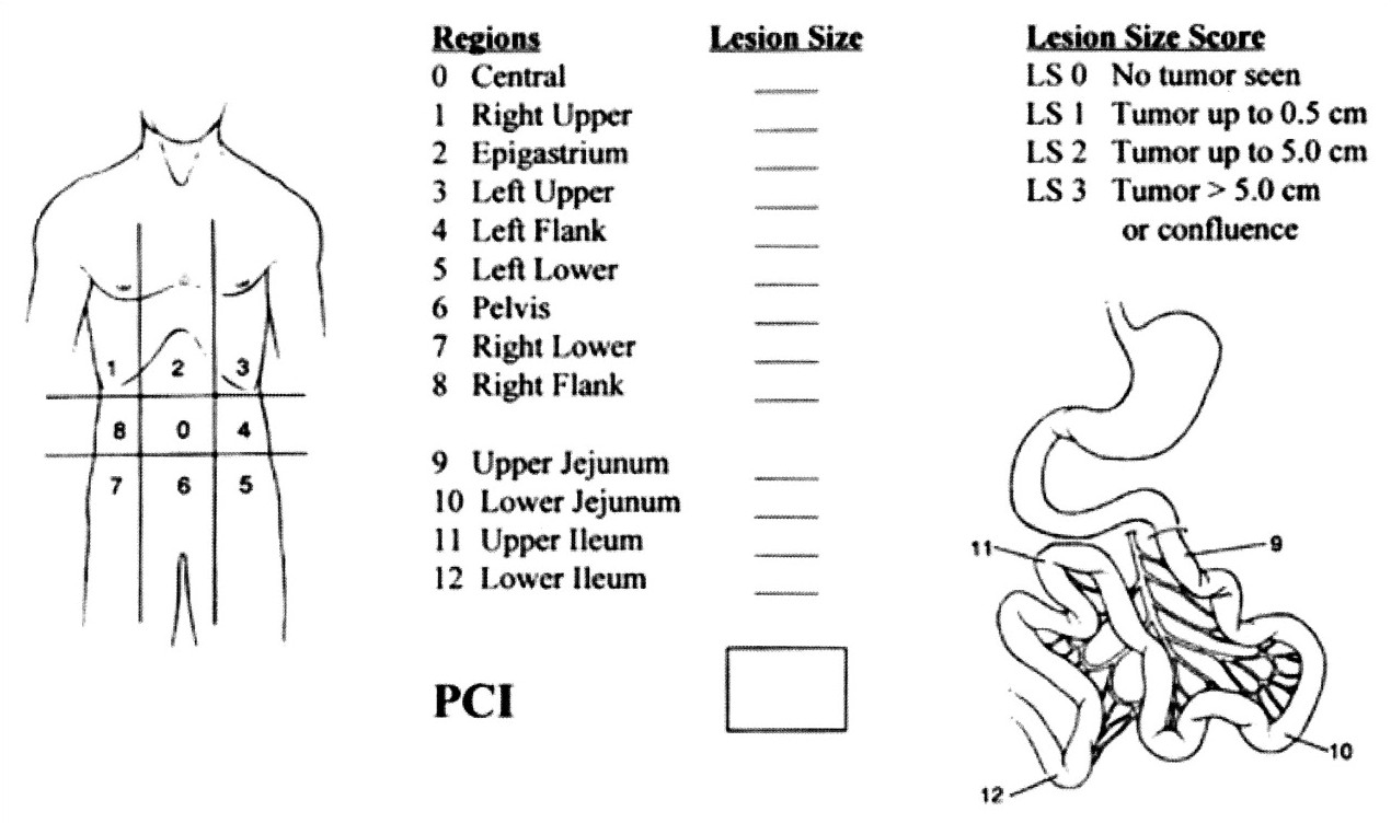 PCI according to Sugarbaker et al 31